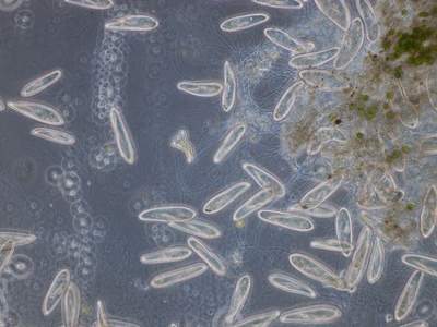 Monitoring plankton diversity 